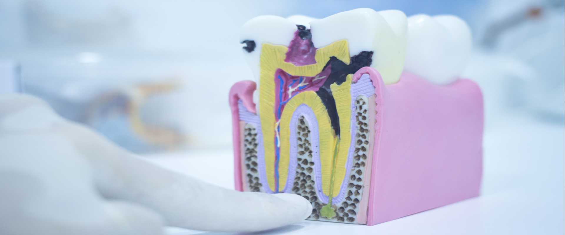 The Truth About Diabetes And Your Teeth