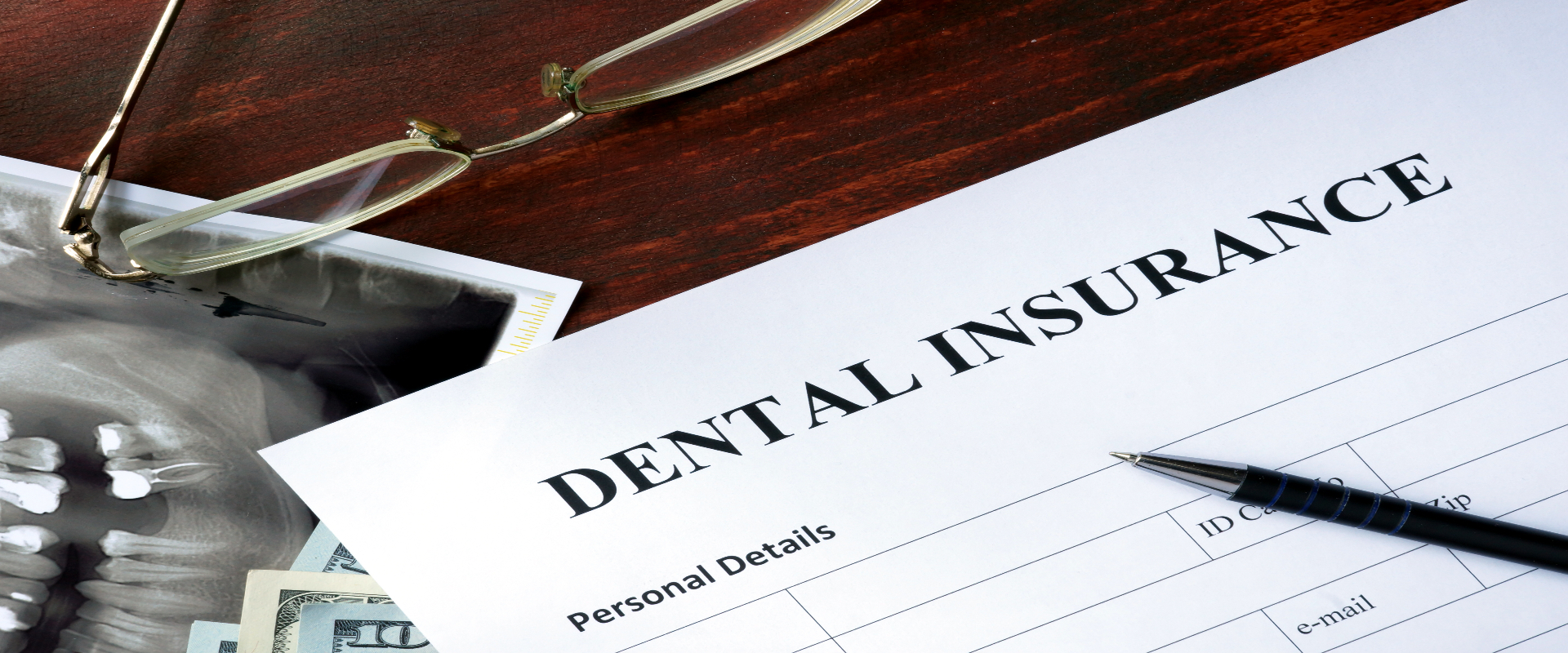 Your Dental Insurance Benefit Questions Answered