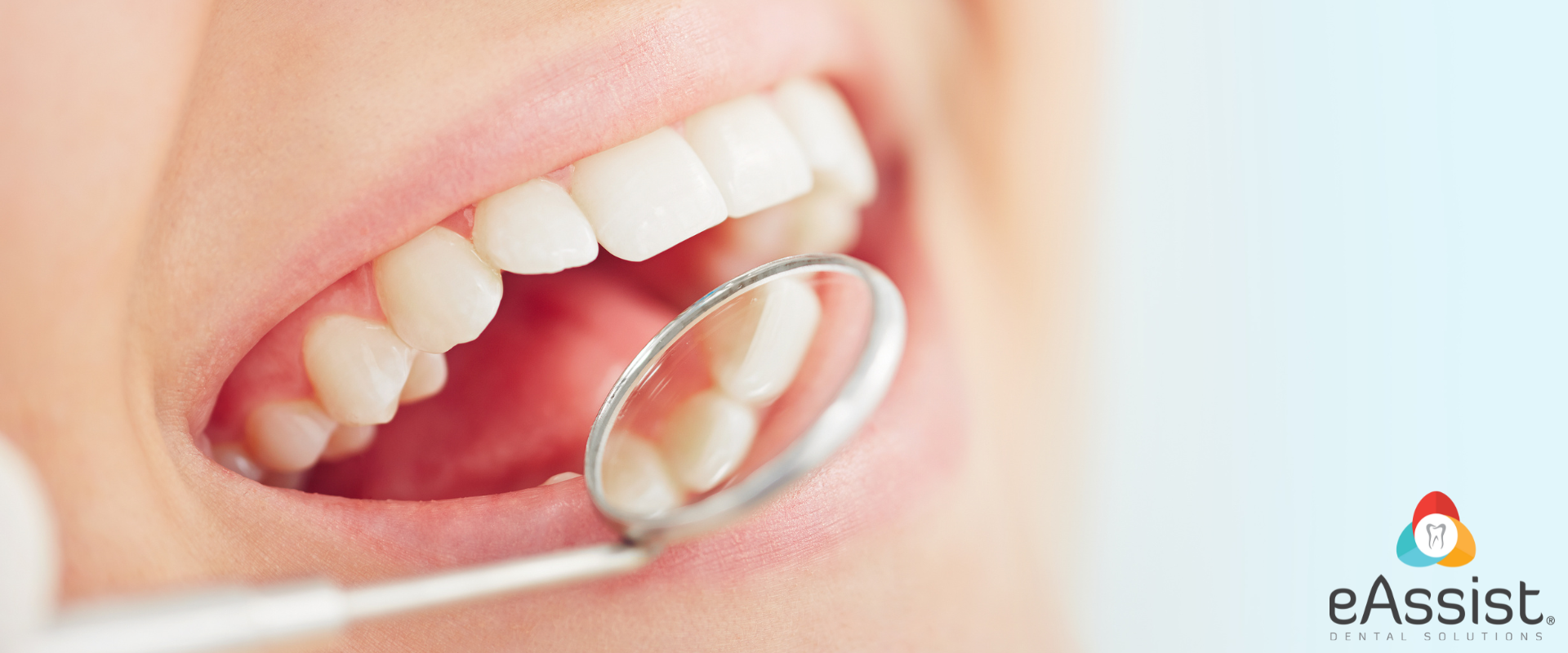 How to Get SRP Claims Paid 